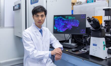 Penelitian Bersama Hong Kong Baptist University Mengungkapkan, Tes Cytomegalovirus Urin Dapat Mengidentifikasi Risiko Penyakit Organ Akhir untuk Pasien AIDS